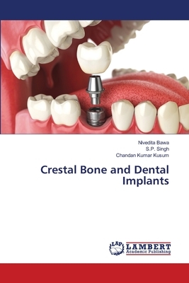 Crestal Bone and Dental Implants by Nivedita Bawa, Chandan Kumar Kusum, S. P. Singh