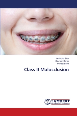 Class II Malocclusion by Jan Mohd Bhat, Saurabh Sonar, Puneet Batra