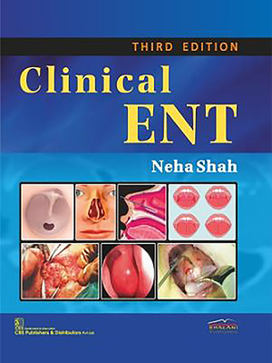 Clinical Ent by Neha Shah