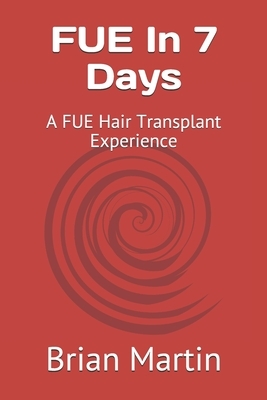 FUE In 7 Days: A FUE Hair Transplant Experience by Brian Martin