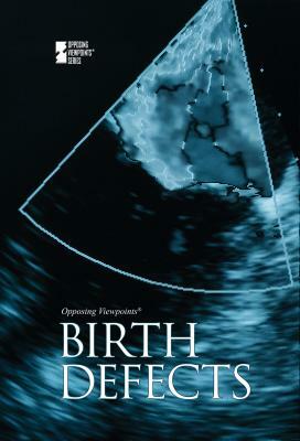 Birth Defects by Noel Merino