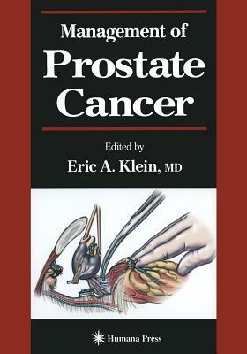 Management of Prostate Cancer by 