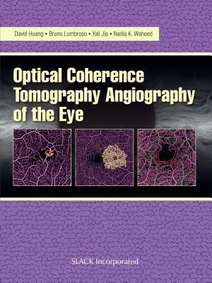 Optical Coherence Tomography Angiography of the Eye: Oct Angiography by Yali Jia, David Huang, Bruno Lumbroso