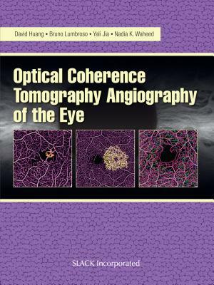 Optical Coherence Tomography Angiography of the Eye: Oct Angiography by Bruno Lumbroso, David Huang, Yali Jia