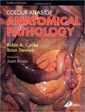 Colour Atlas of Anatomical Pathology by Robin A. Cooke, Brian Stewart
