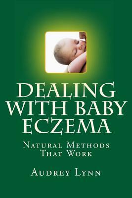 Dealing With Baby Eczema: Natural Methods That Work by Audrey Lynn