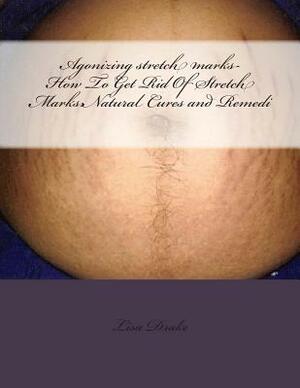 Agonizing stretch marks-How To Get Rid Of Stretch Marks: Natural Cures and Remedi by Lisa Drake