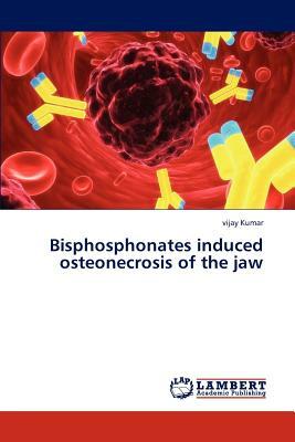 Bisphosphonates Induced Osteonecrosis of the Jaw by Kumar Vijay