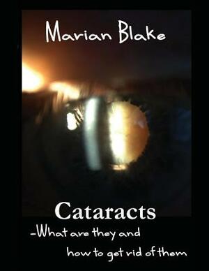 Cataracts: What are they and how to get rid of them? by Marian Blake