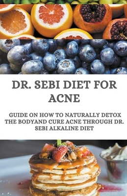 Dr. Sebi Diet For Acne; Guide On How to Naturally Detox the Body And Cure Acne Through Dr. Sebi Alkaline Diet by Henry Allen