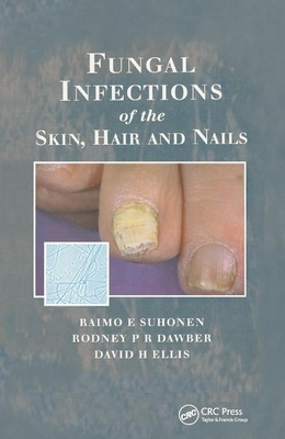 Fungal Infections of the Skin and Nails by Rodney P. R. Dawber, David H. Ellis, Raimo E. Suhonen