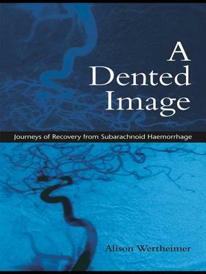 A Dented Image: Journeys of Recovery from Subarachnoid Haemorrhage by Alison Wertheimer