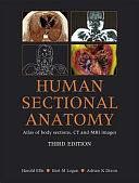 Human Sectional Anatomy: Atlas of Body Sections, CT and MRI Images, Third Edition by Bari M Logan, Adrian K. Dixon, Harold Ellis