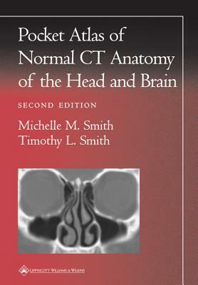 Pocket Atlas of Normal CT Anatomy of the Head and Brain by Michelle M. Smith, Timothy L. Smith