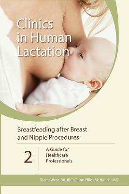 Breastfeeding after Breast and Nipple Procedures: A Guide for Healthcare Professionals by Elliot M. Hirsch, Diana West