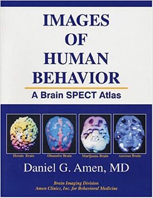 Images of Human Behavior: A Brain SPECT Atlas by Daniel G. Amen