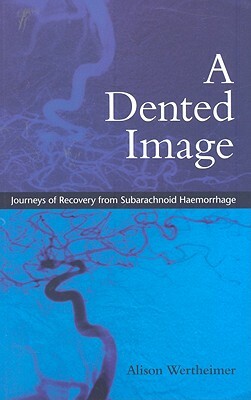 A Dented Image: Journeys of Recovery from Subarachnoid Haemorrhage by Alison Wertheimer