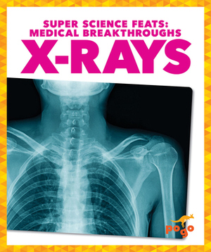 X-Rays by Alicia Z. Klepeis