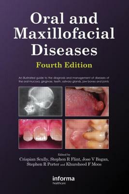 Oral and Maxillofacial Diseases, Fourth Edition by Stephen Flint, Crispian Scully