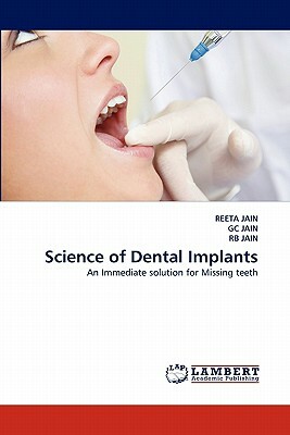 Science of Dental Implants by Rb Jain, Gc Jain, Reeta Jain