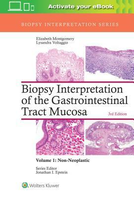 Biopsy Interpretation of the Gastrointestinal Tract Mucosa: Volume 1: Non-Neoplastic by Elizabeth A. Montgomery, Lysandra Voltaggio