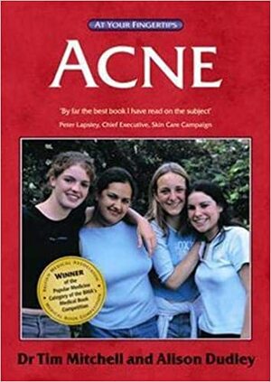 Acne: The 'At Your Fingertips' Guide by Alison Dudley, Tim Mitchell