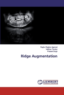 Ridge Augmentation by Vaibhav Tandon, Prateek Singh, Raghu Raghav Agarwal