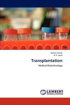 Transplantation by D. P. Jaroli, Hardik Pathak