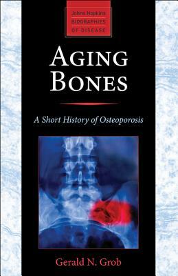 Aging Bones: A Short History of Osteoporosis by Gerald N. Grob