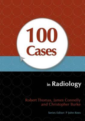 100 Cases in Radiology by Robert Thomas, Christopher Burke, James Connelly