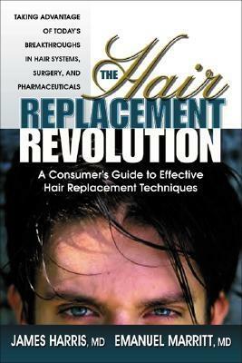 The Hair Replacement Revolution: A Consumer's Guide to Effective Hair Replacement Techniques by James Harris, Emanuel Marritt