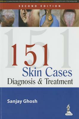 151 Skin Cases: Diagnosis and Treatment by Sanjay Ghosh