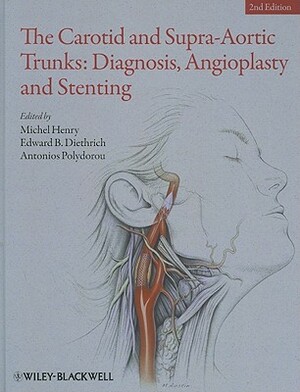 The Carotid and Supra-Aortic Trunks: Diagnosis, Angioplasty and Stenting by Antonios Polydorou, Michel Henry, Edward B. Diethrich
