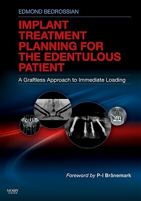 Implant Treatment Planning for the Edentulous Patient: A Graftless Approach to Immediate Loading by Edmond Bedrossian