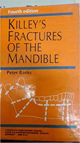 Killey's Fractures of the Mandible by Peter Banks