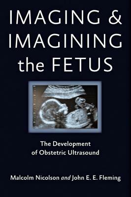 Imaging and Imagining the Fetus: The Development of Obstetric Ultrasound by Malcolm Nicolson, John E. E. Fleming
