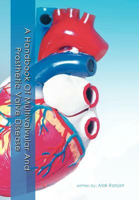 A Handbook of Multivalvular and Prosthetic Valve Disease by Alok Ranjan