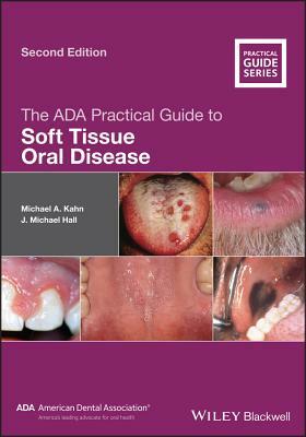 The ADA Practical Guide to Soft Tissue Oral Disease by J. Michael Hall, Michael A. Kahn