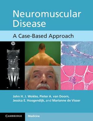 Neuromuscular Disease: A Case-Based Approach by Jessica E. Hoogendijk, John H. J. Wokke, Pieter A. Van Doorn