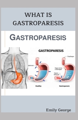 What Is Gastroparesis by Emily George