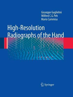 High-Resolution Radiographs of the Hand by Mario Cammisa, Wilfred C. G. Peh, Giuseppe Guglielmi