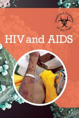 HIV and AIDS by Randall McPartland, Holly Cefrey