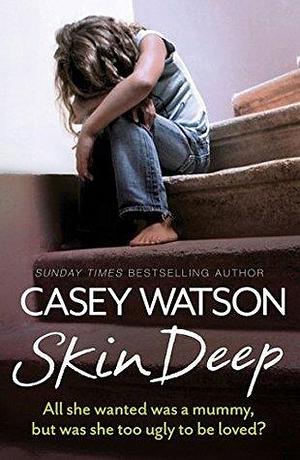 Skin Deep: All she wanted was a mummy, but was she too ugly to be loved? by Casey Watson, Casey Watson