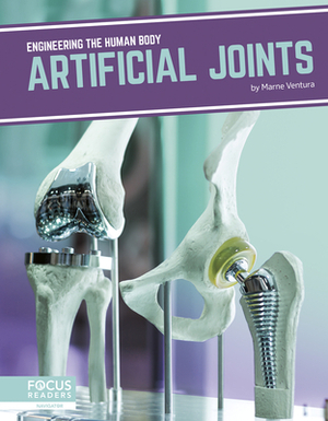 Artificial Joints by Marne Ventura