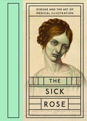The Sick Rose: Disease and the Art of Medical Illustration by Richard Barnett