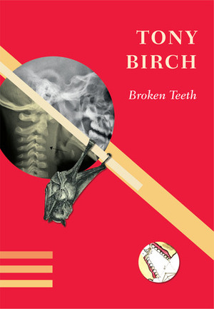 Broken Teeth by Tony Birch