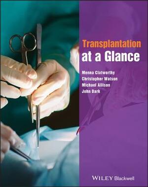 Transplantation at a Glance by Michael Allison, Menna Clatworthy, Christopher Watson