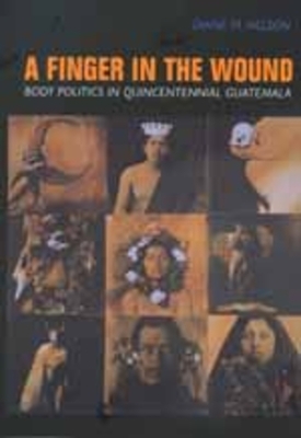 A Finger in the Wound: Body Politics in Quincentennial Guatemala by Diane M. Nelson