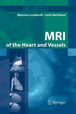 MRI of the Heart and Vessels by Massimo Lombardi
