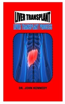 Liver Transplant: Liver Transplant Process by John Kennedy